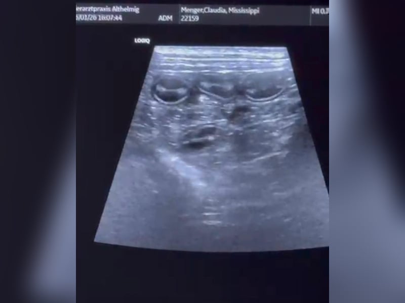 Coton de Tulear Welpen