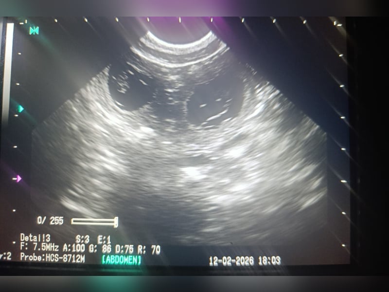 Deutscher Pinscher Welpen ab März 2026