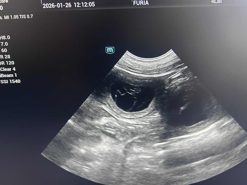 Flat Coated Retriever